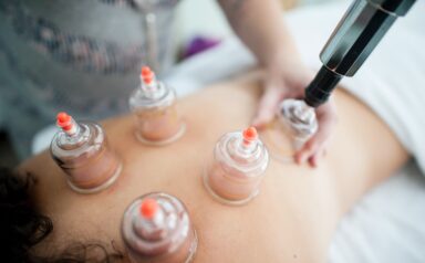 Cupping